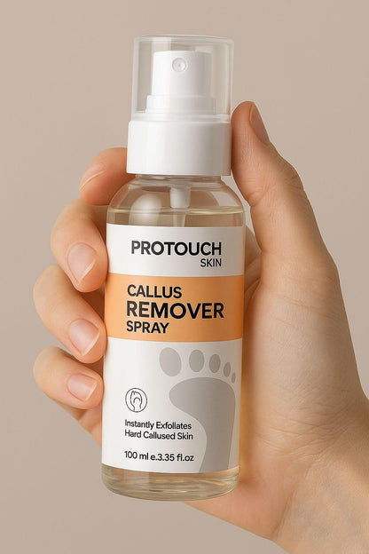 SoleSmooth™ Callus Care Spray